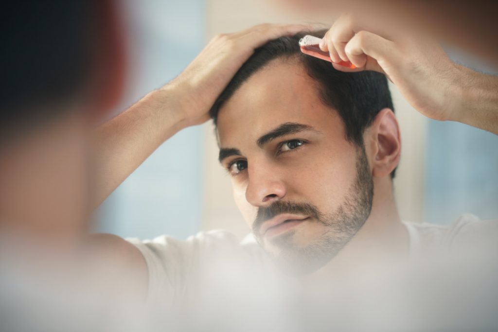 Man with low progesterone symptoms including balding